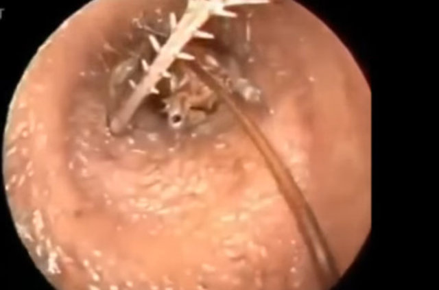 Kulağından öyle bir şey çıktı ki... - 4