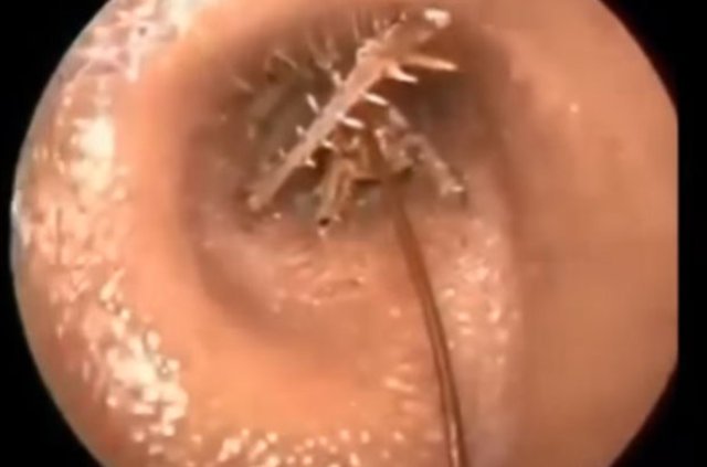 Kulağından öyle bir şey çıktı ki... - 6