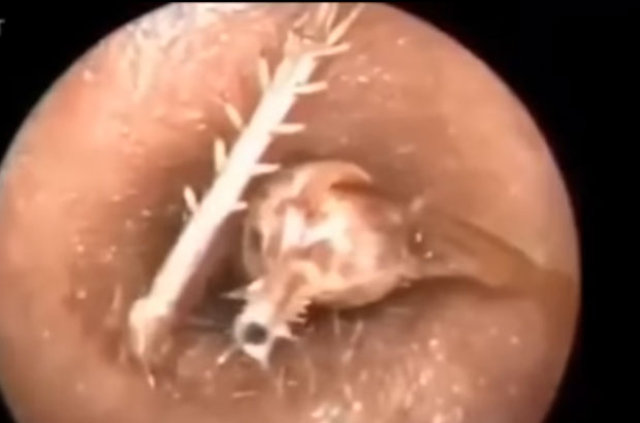 Kulağından öyle bir şey çıktı ki... - 7