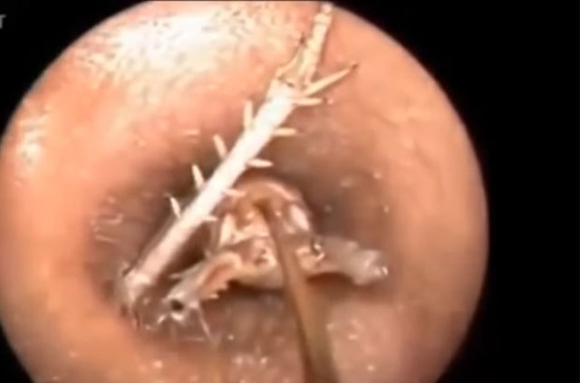 Kulağından öyle bir şey çıktı ki... - 9