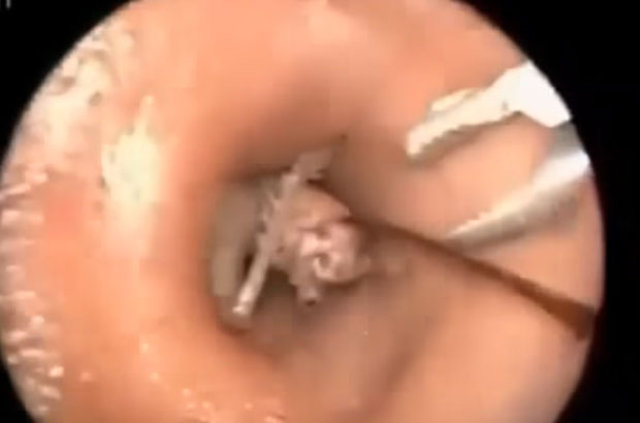 Kulağından öyle bir şey çıktı ki... - 10