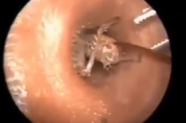 Kulağından öyle bir şey çıktı ki... - 11