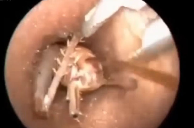 Kulağından öyle bir şey çıktı ki... - 12