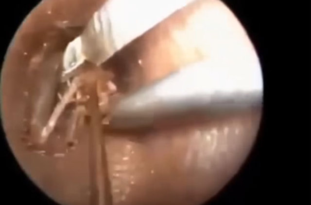 Kulağından öyle bir şey çıktı ki... - 13