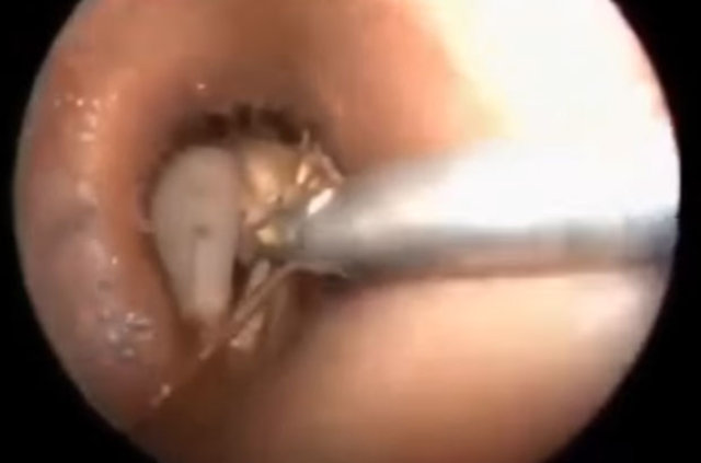 Kulağından öyle bir şey çıktı ki... - 14