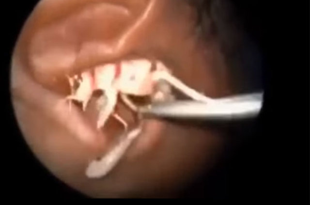 Kulağından öyle bir şey çıktı ki... - 19