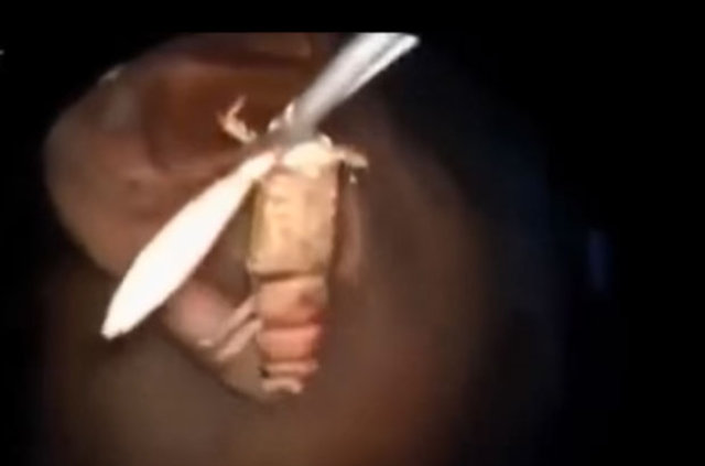 Kulağından öyle bir şey çıktı ki... - 20