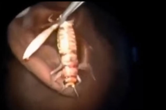 Kulağından öyle bir şey çıktı ki... - 21