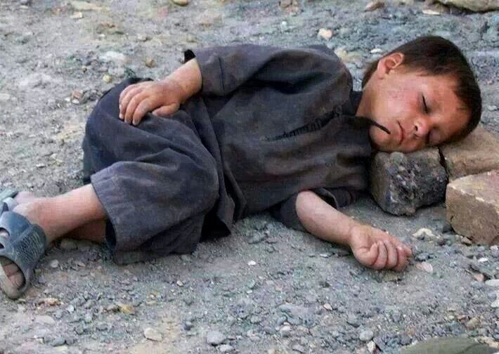 Suriyeli çocukların görünmez yaraları - 21