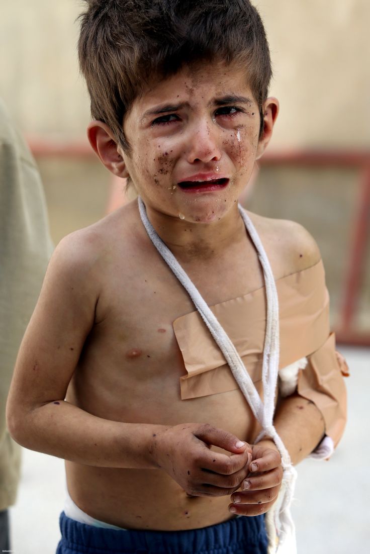 Suriyeli çocukların görünmez yaraları - 27