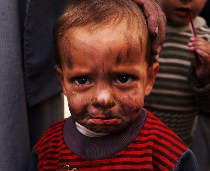 Suriyeli çocukların görünmez yaraları - 22