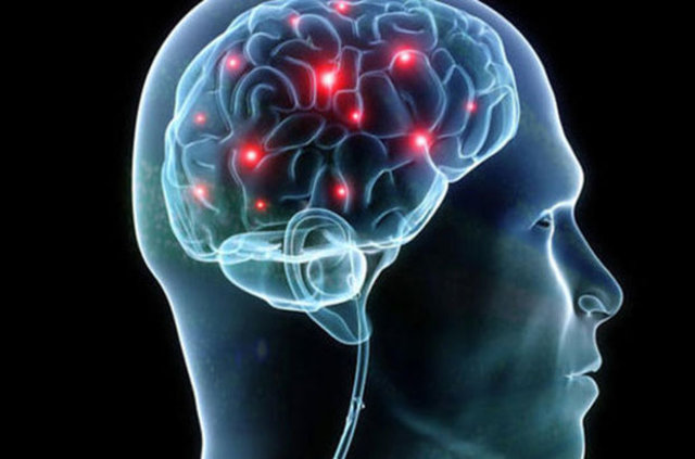 Beyin yaşınızı böyle hesaplayın! - 31