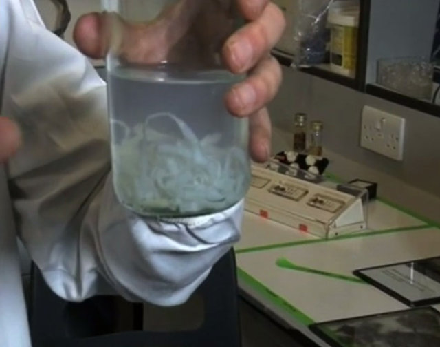 Midesinden tam 183 santimlik kurt çıkardılar! - 3