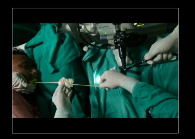 Midesinden tam 183 santimlik kurt çıkardılar! - 11