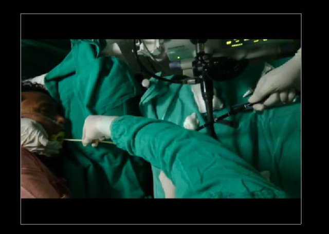 Midesinden tam 183 santimlik kurt çıkardılar! - 13