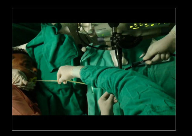 Midesinden tam 183 santimlik kurt çıkardılar! - 14