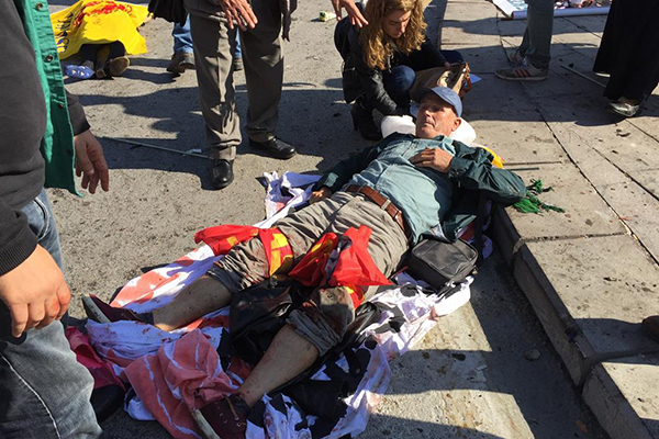 Ankara'da patlama: 47 ölü, 100 yaralı - 2