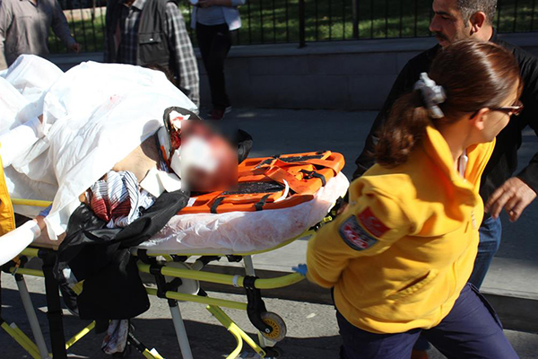 Ankara'da patlama: 47 ölü, 100 yaralı - 5