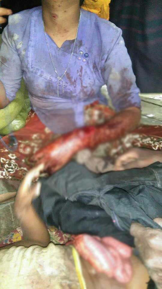 Arakan'da katliam var! - 3