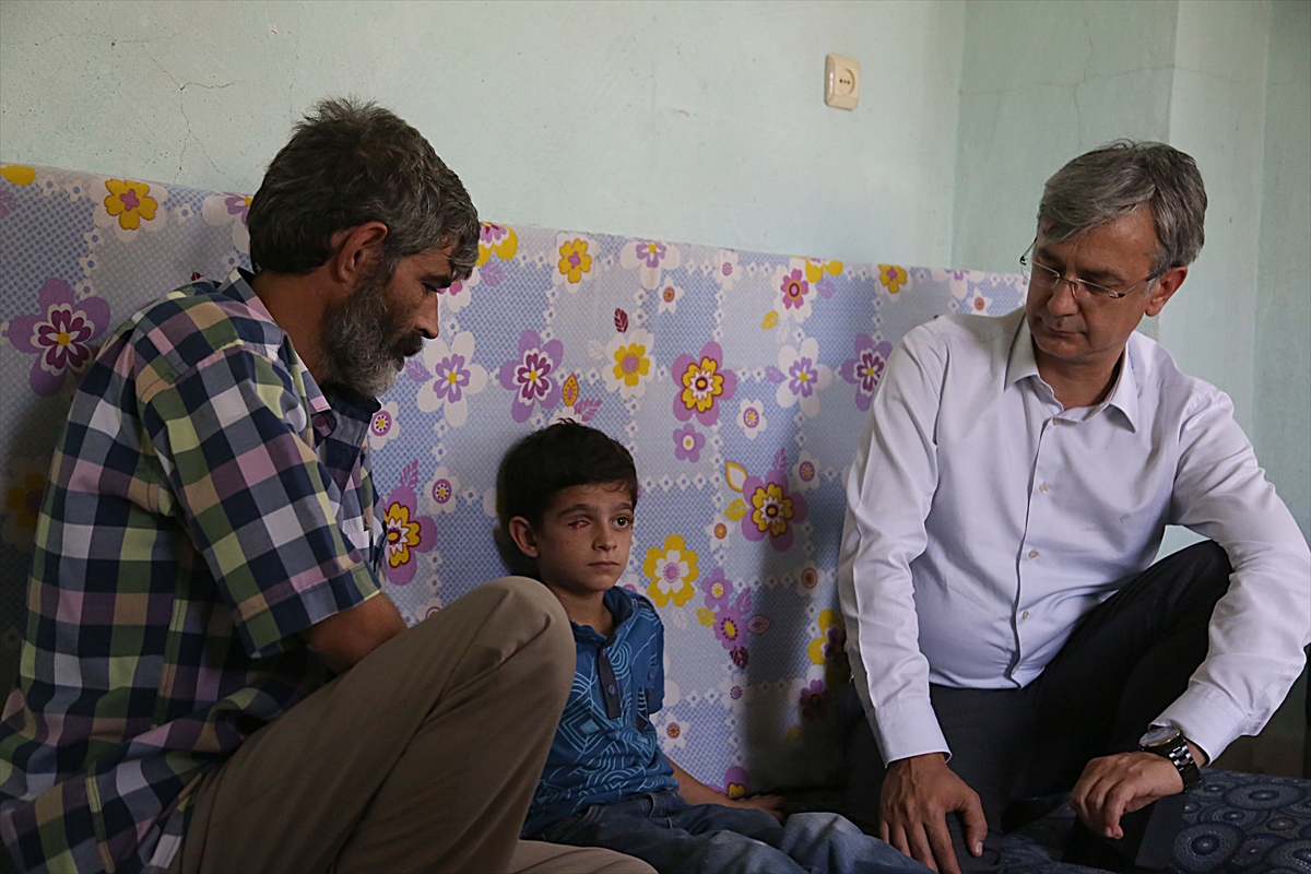 Suriyeli Mahmut'a protez göz müjdesi - 2