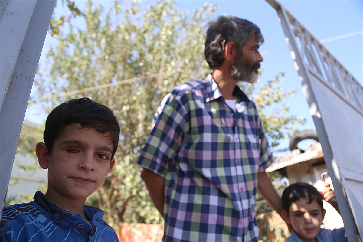 Suriyeli Mahmut'a protez göz müjdesi - 5