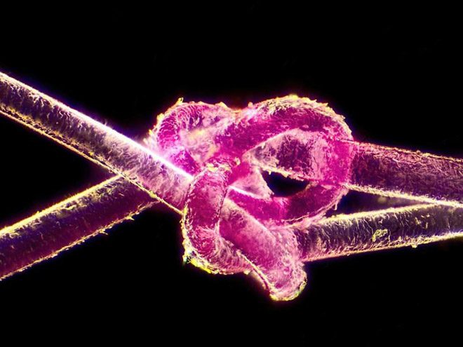 2017 Nikon makro fotoğraflar yarışmasının kazananları işte bu kareleri çekmiş! - 25