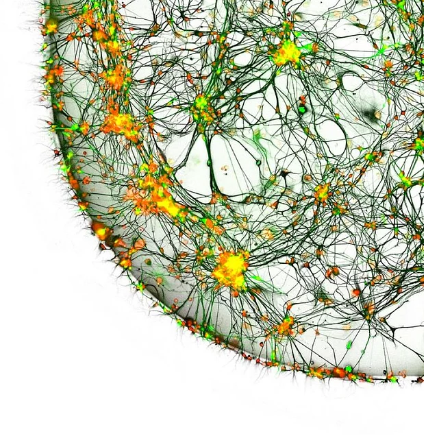 2017 Nikon makro fotoğraflar yarışmasının kazananları işte bu kareleri çekmiş! - 10