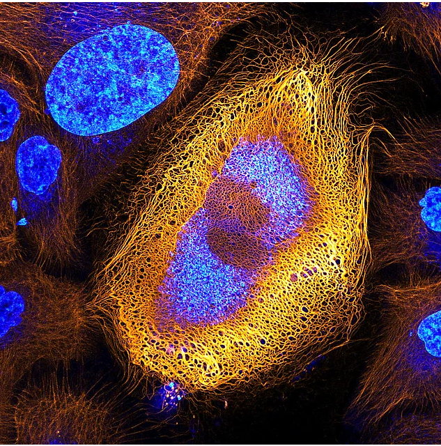 2017 Nikon makro fotoğraflar yarışmasının kazananları işte bu kareleri çekmiş! - 2