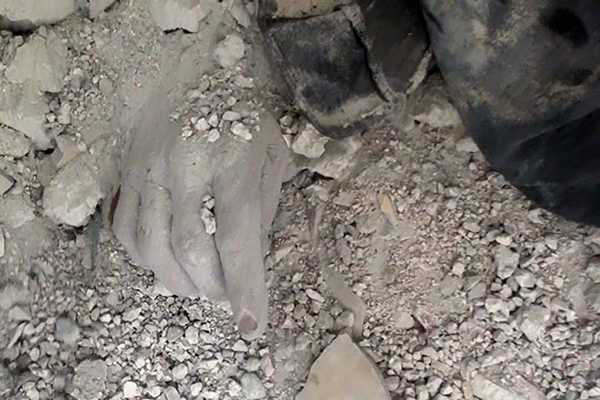 Guta'da gözler önünde sivil katliamı - 6