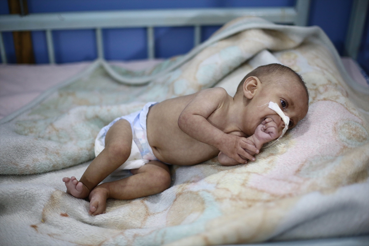 Doğu Guta'da bir çocuk daha öldü - 0