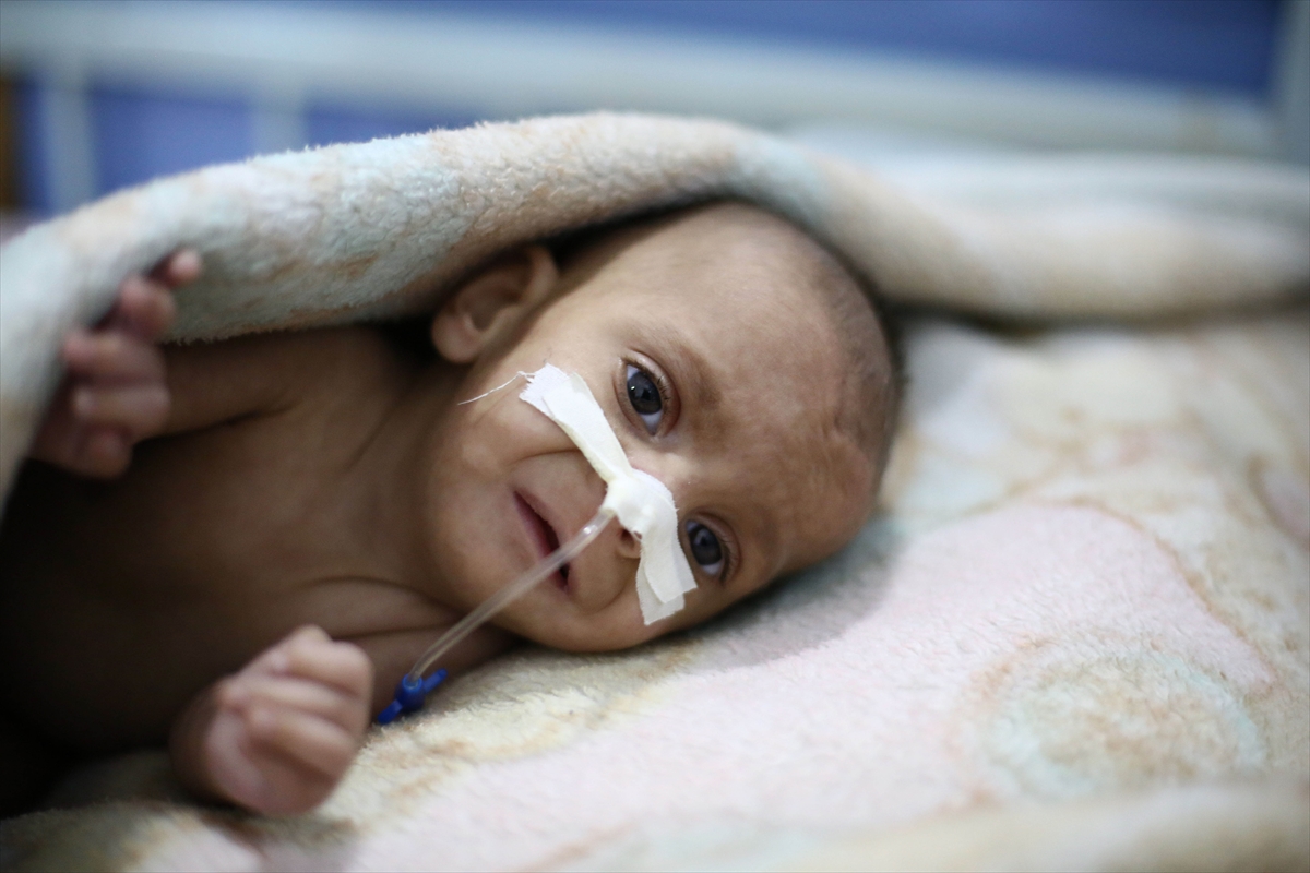 Doğu Guta'da bir çocuk daha öldü - 0