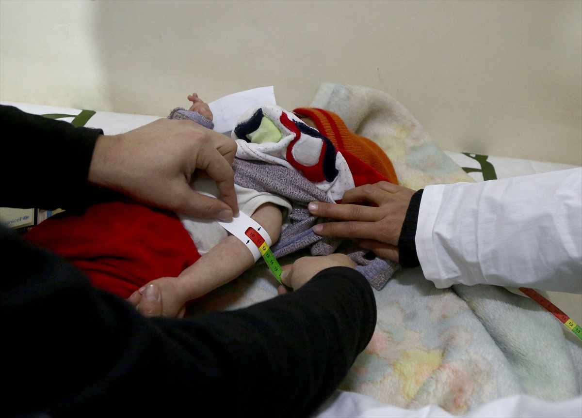 Doğu Guta'da bir çocuk daha öldü - 0