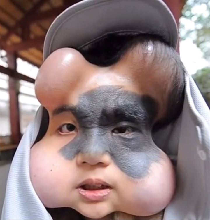 Doktorlar bu hale getirdi - 2