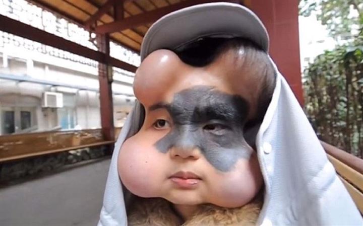 Doktorlar bu hale getirdi - 6