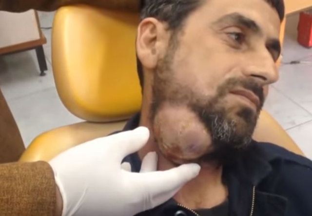 Neşteri vurunca gözlerine inanamadılar - 1