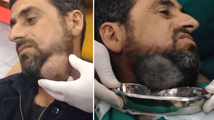 Neşteri vurunca gözlerine inanamadılar - 2