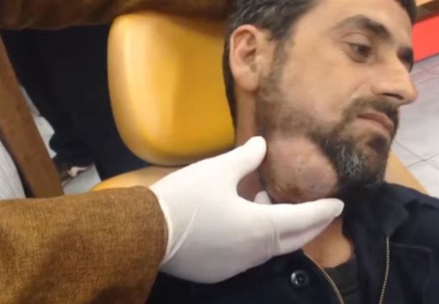 Neşteri vurunca gözlerine inanamadılar - 3