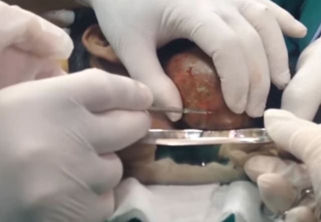 Neşteri vurunca gözlerine inanamadılar - 4