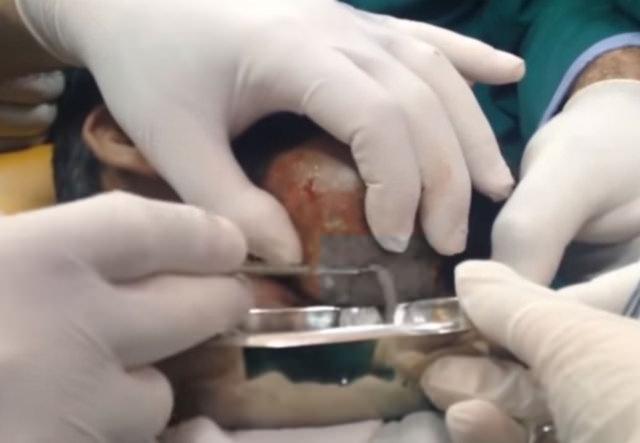 Neşteri vurunca gözlerine inanamadılar - 6