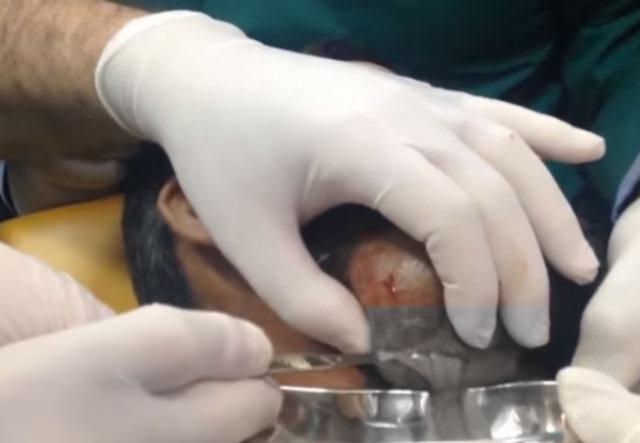 Neşteri vurunca gözlerine inanamadılar - 8