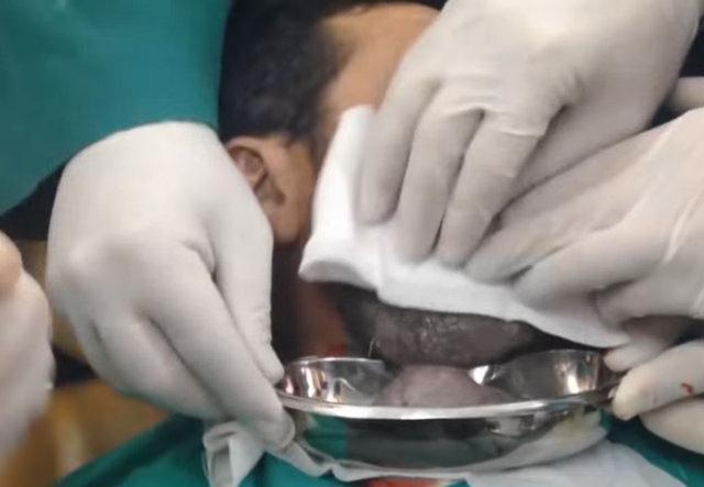 Neşteri vurunca gözlerine inanamadılar - 9