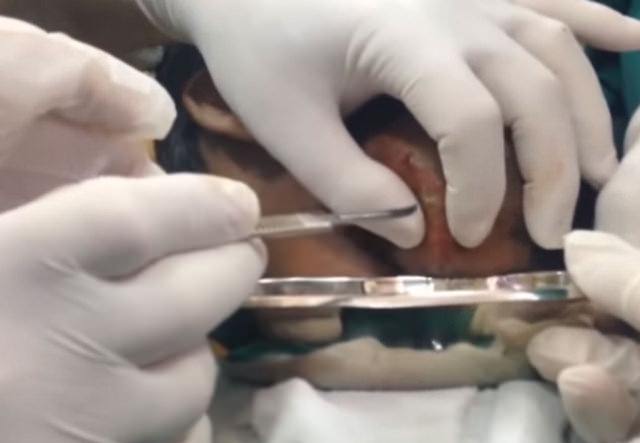 Neşteri vurunca gözlerine inanamadılar - 11