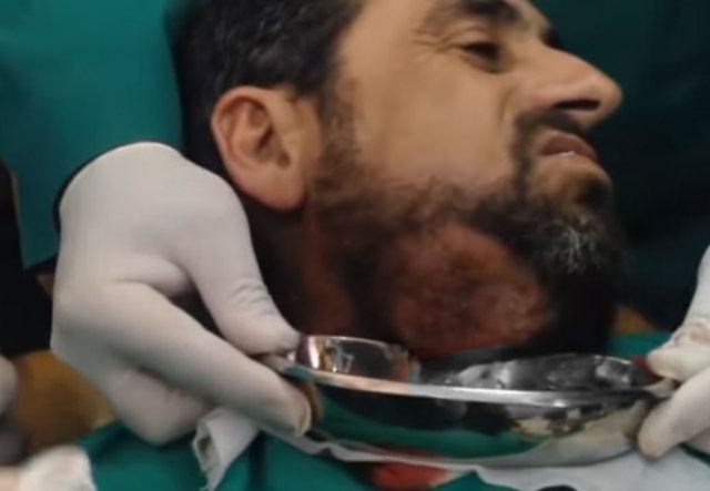 Neşteri vurunca gözlerine inanamadılar - 13