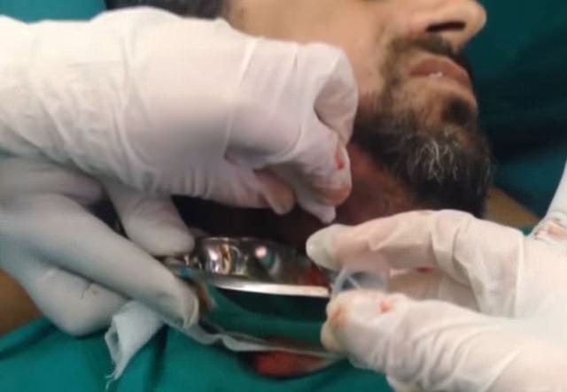 Neşteri vurunca gözlerine inanamadılar - 14