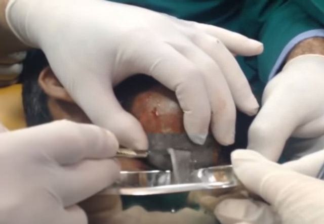 Neşteri vurunca gözlerine inanamadılar - 15