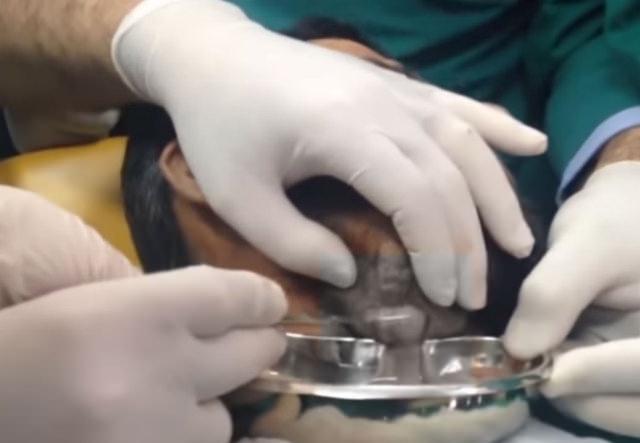 Neşteri vurunca gözlerine inanamadılar - 16