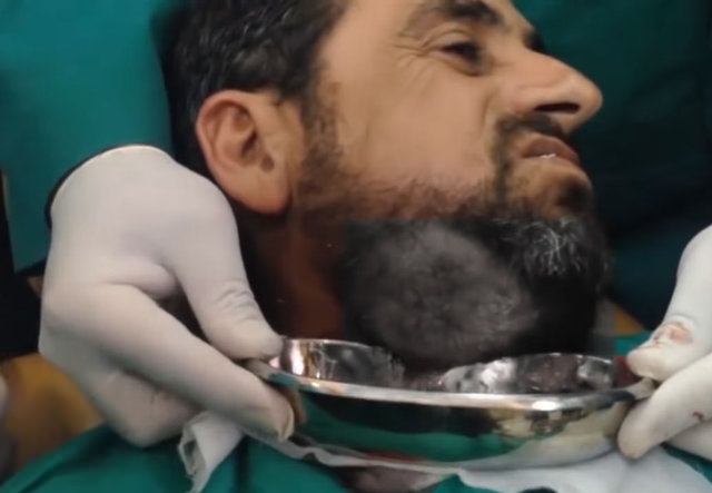 Neşteri vurunca gözlerine inanamadılar - 17