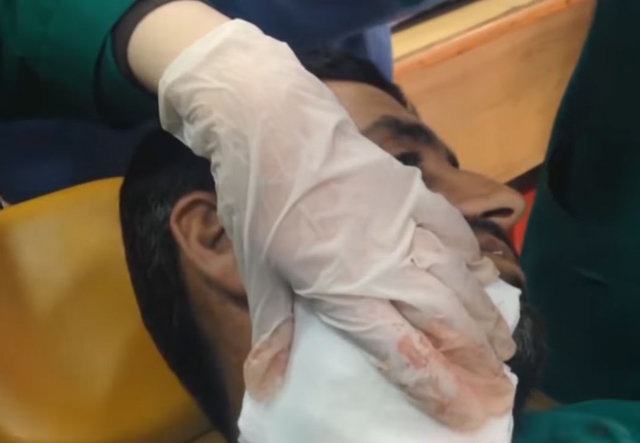 Neşteri vurunca gözlerine inanamadılar - 18