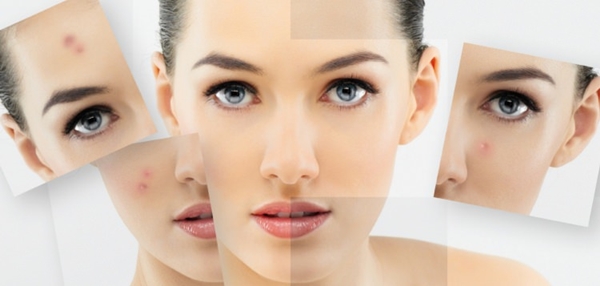 Sivilceye bunlar sebep oluyor! - 3