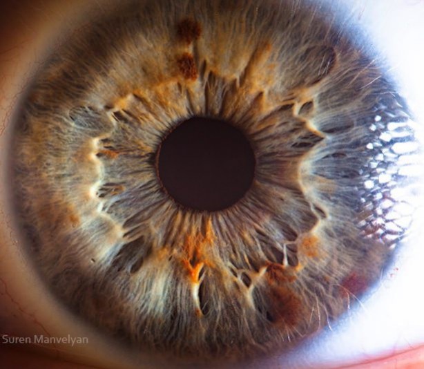 Gözlere bir de yakından bakın - 1